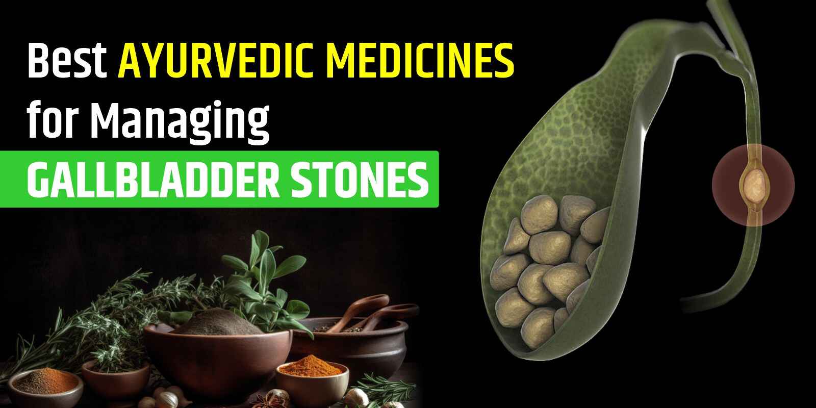 Best Ayurvedic Medicines for Managing Gallbladder Stones